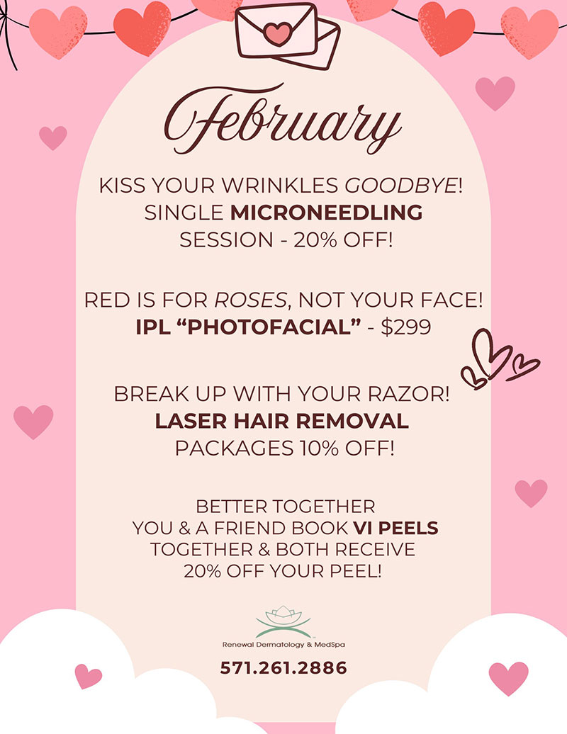 February Specials 2026
